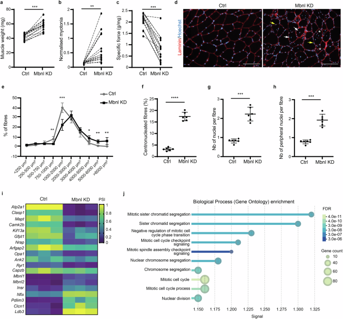MBNL depletion drives stem cell fusion and immature myonuclear states in myotonic dystrophy type 1