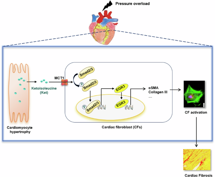 Hypertrophic cardiomyocytes promote cardiac fibrosis through paracrine secretion of ketoisoleucine in pressure-overloade