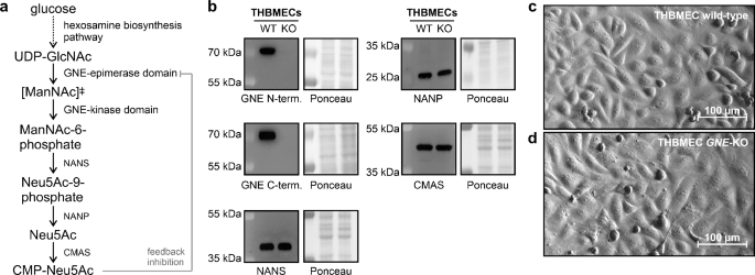 Modulating the sialic acid content of endothelial cells affects their adhesion and barrier permeability